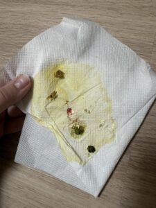 Фото пациента